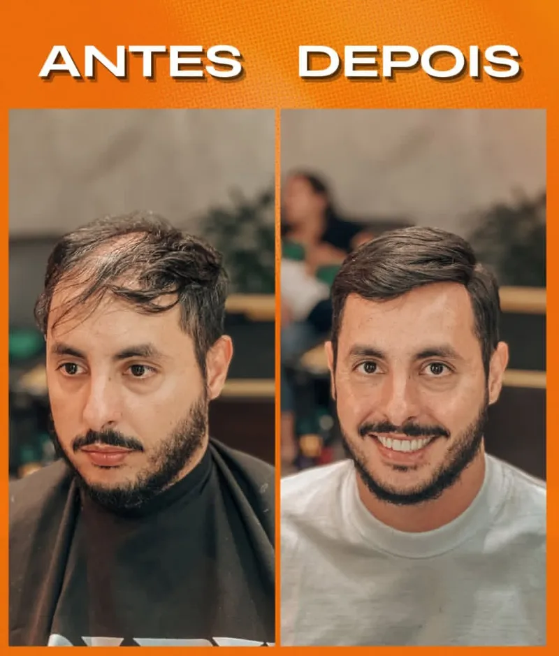 Resultado de prótese capilar com fios naturais aplicado na Figaro's Barbearia